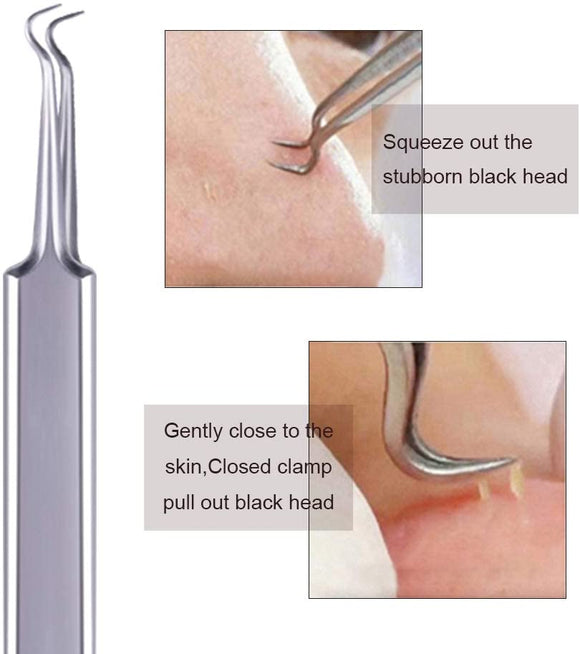 (イオーノ)毛抜き ニキビ取り 黒ずみ取り いちご 角栓取り鼻ケア 毛穴ケア ピンセット コメドプッシャー アクネプッシャーキット収納ケース付き 携帯便利 精密 専用4本セット#77313